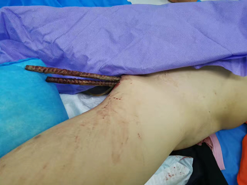 微信图片_20170512191840.png