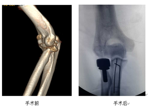 QQ截图20180820161507.png