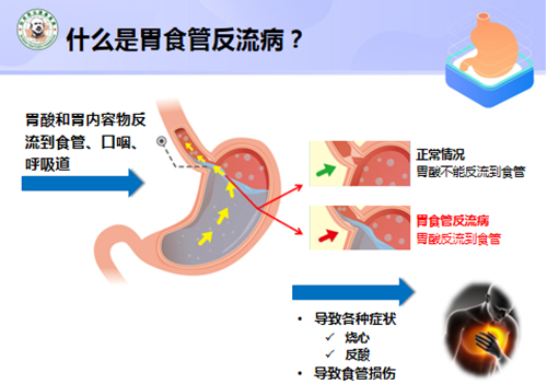 喝水呛了什么原理_喝水被呛到的图片(3)