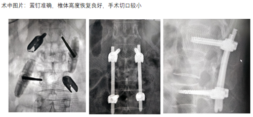 子洲4.png