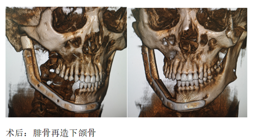 口腔3_副本