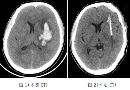 神经外科1