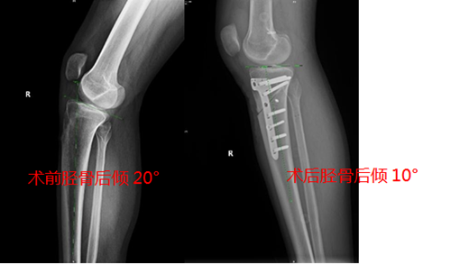 关节外科1_副本1
