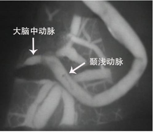 神外2.png