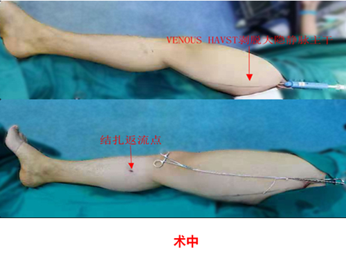 血管外科2_副本